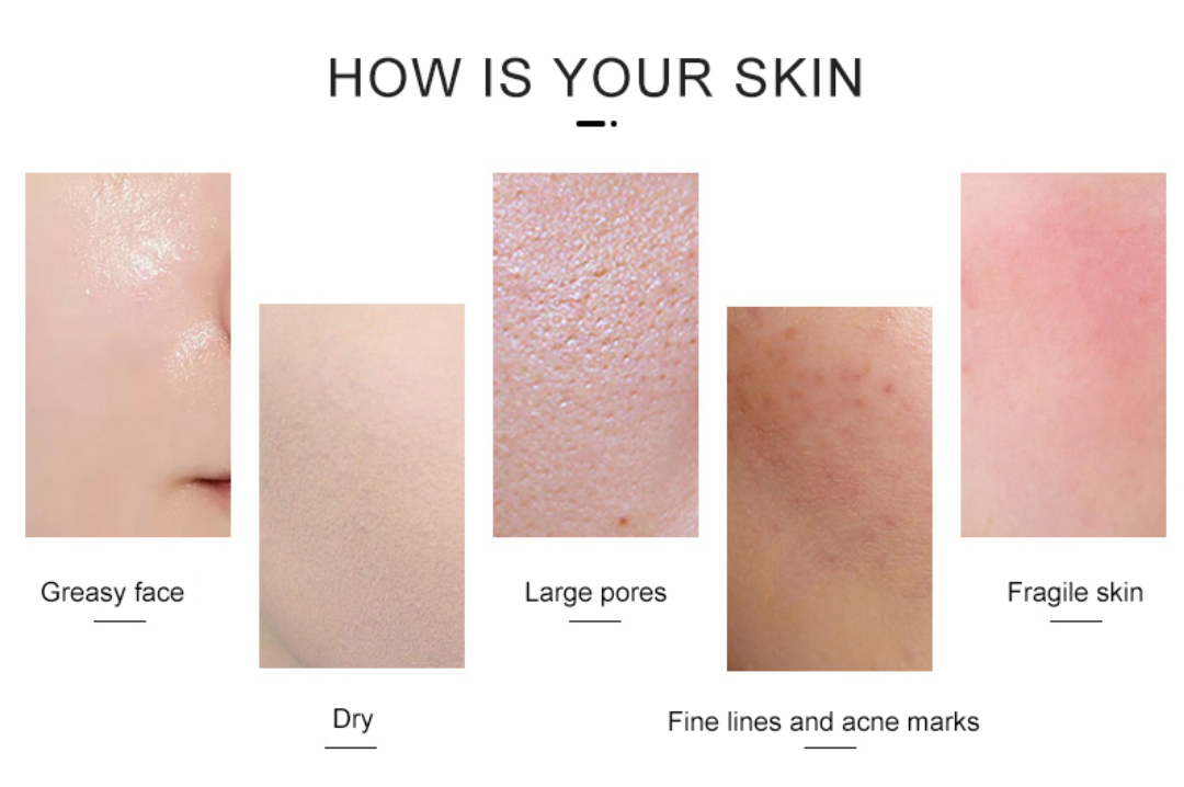 how is your skin